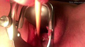 Cervix stretched wide open