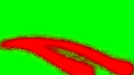 Chuunibyou demo koi ga shitai ren 06 episode review