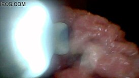 uh, i dunno how this endoscope shows penis close-ups for education...