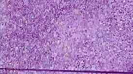 why does tingting pee outdoors in women's clothes?