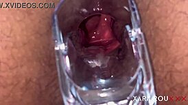 Detailed anal examination with speculum reveals tight, gaping asshole of mature BBW slut