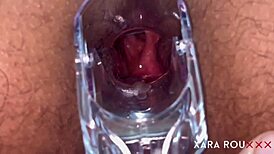 Detailed anal examination with speculum reveals tight, gaping asshole of mature BBW slut