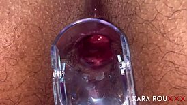Detailed anal examination with speculum reveals tight, gaping asshole of mature BBW slut