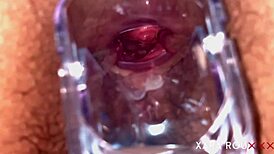 Detailed anal examination with speculum reveals tight, gaping asshole of mature BBW slut