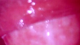 so this step sis takes a close-up facial blast in part three.